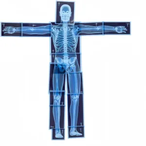 21 Pieces X-Ray Sets of Human Skeleton, Human Nerves, Human Blood Vessels and Human Lymphatic - Xray for Light Table