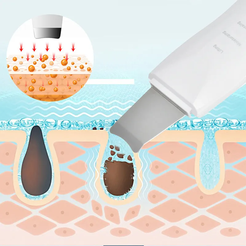 Ultrasonic Ion Facial Massager Blackhead On Face Remove Acne