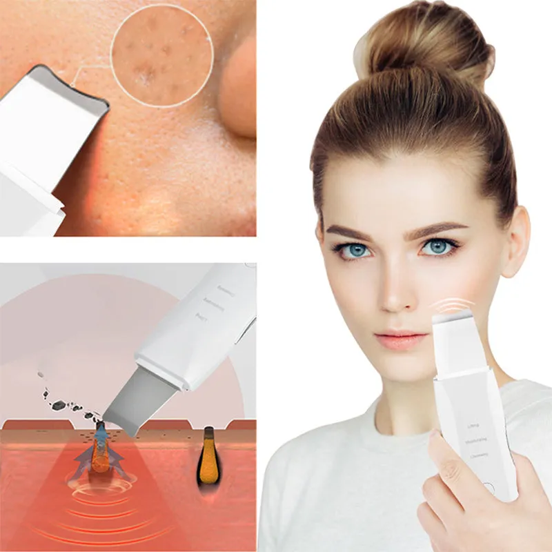 Ultrasonic Ion Facial Massager Blackhead On Face Remove Acne